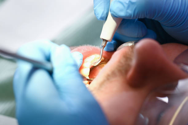 Best Pediatric Emergency Dentist in Maryvle, IL