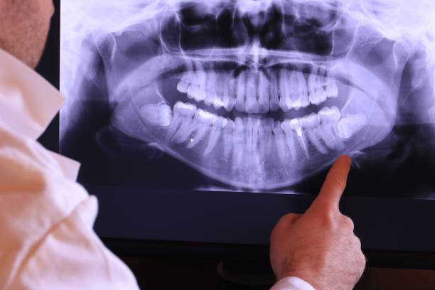 Best Emergency Dentist for Special Needs Patients in Maryvle, IL