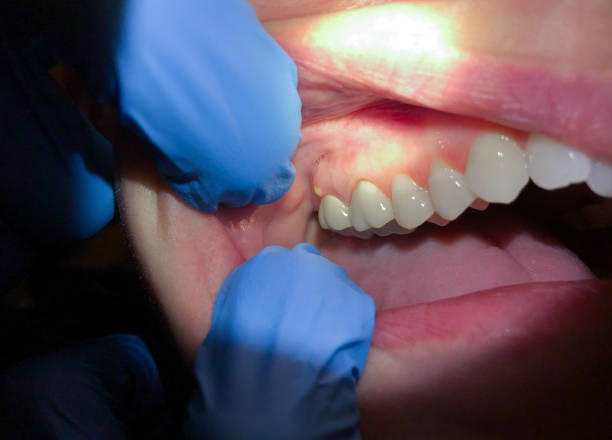 Best Orthodontic Emergency Dentist in Maryvle, IL